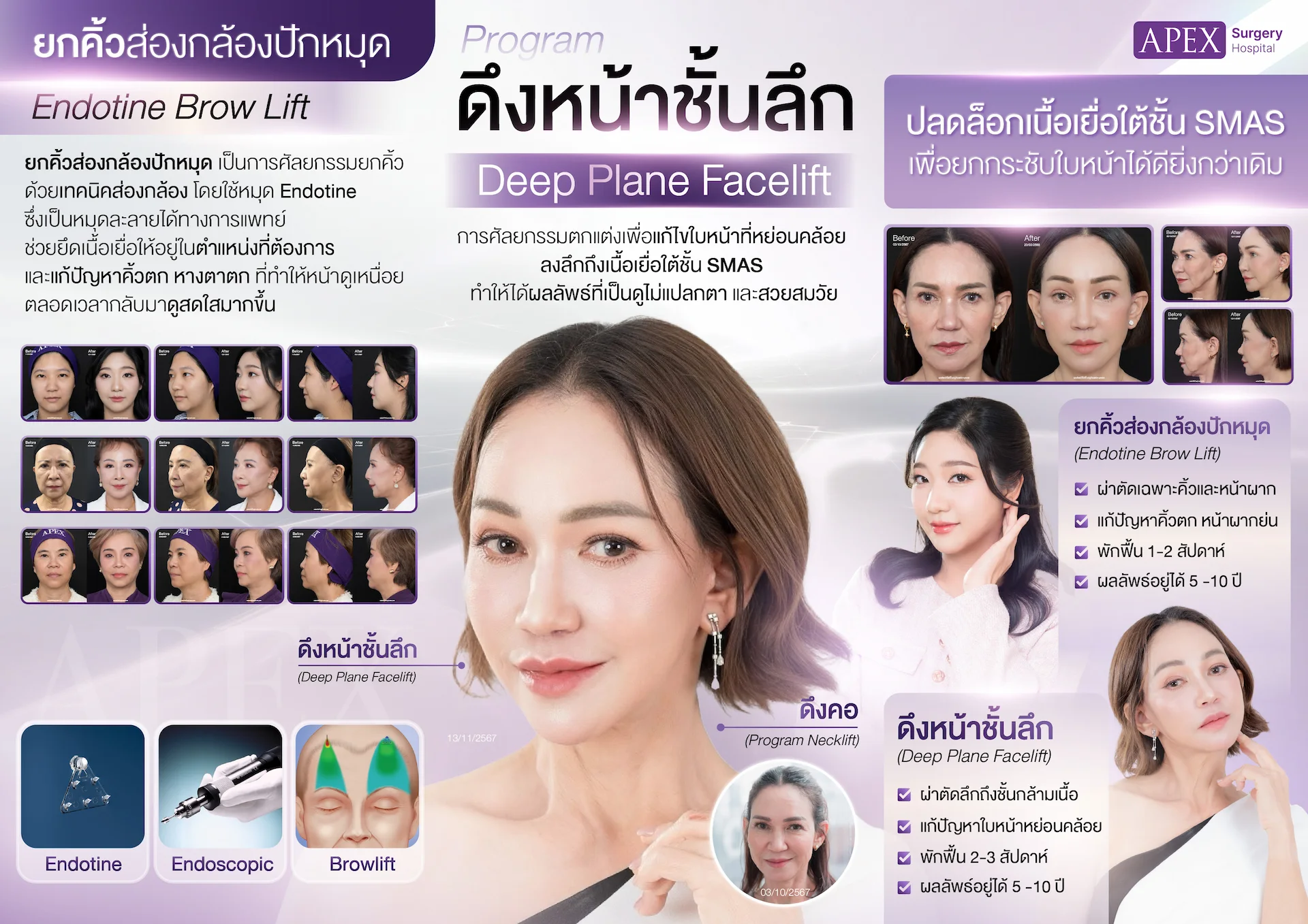 ดึงหน้าชั้นลึก คืออะไร