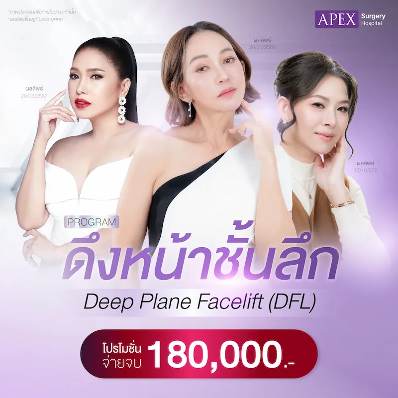 ดึงหน้า-ราคา-180000 apex surgery.