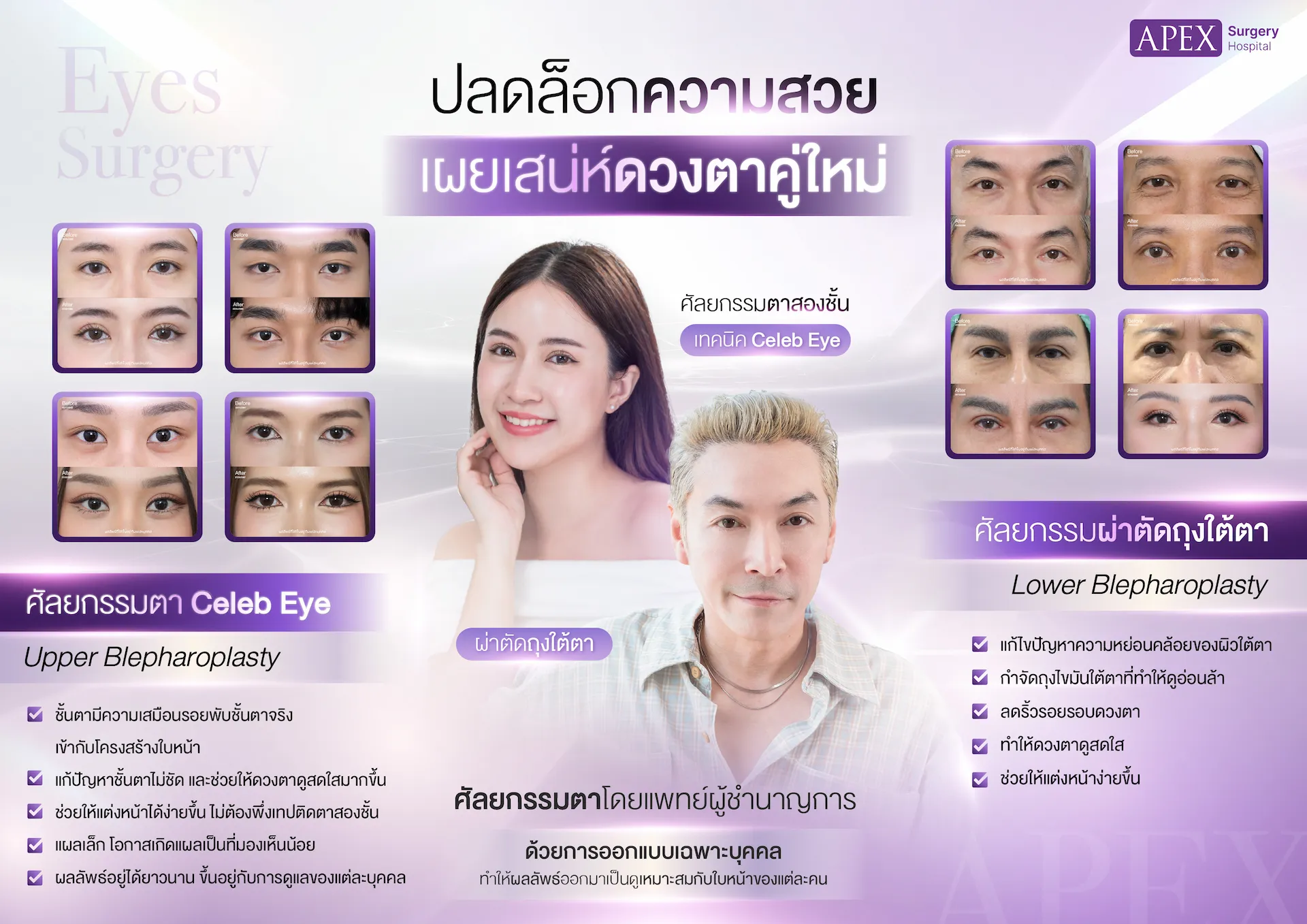 ทำตาสองชั้น Celeb eyes คืออะไร