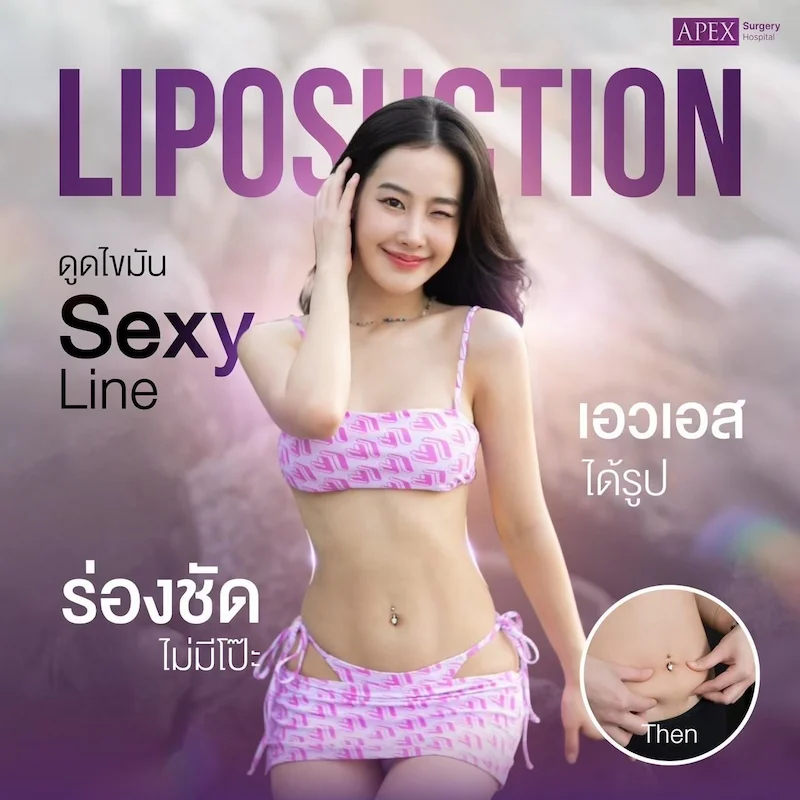 รีวิว ดูดไขมัน