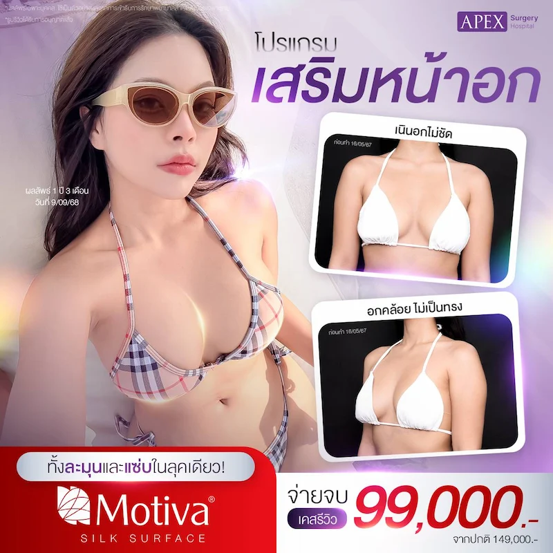 โปรโมชัน เสริมหน้าอก