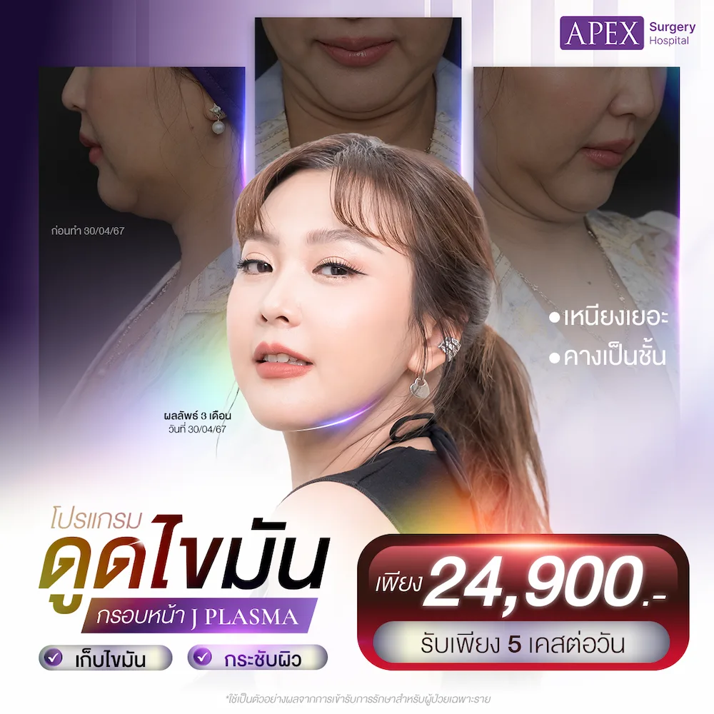 1ต่อ1_โปรดูดไขมันเหนียง_เค้ก_0