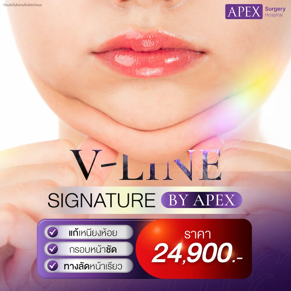 โปรV-Lineแก้เหนียง_1ต่อ1